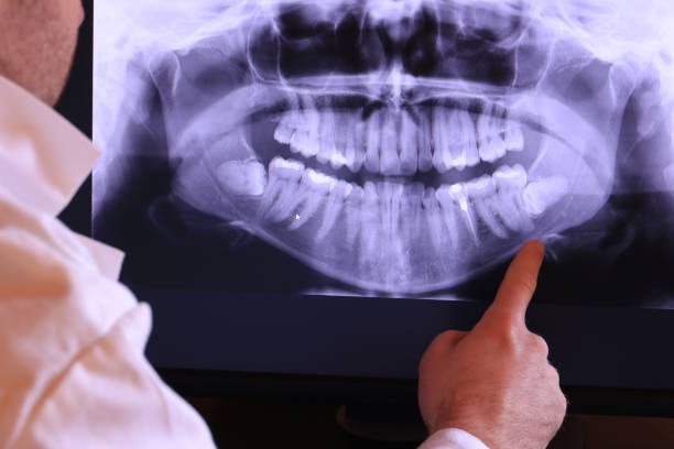 Best Broken or Cracked Tooth Emergency Dentist in Comstock Park, MI