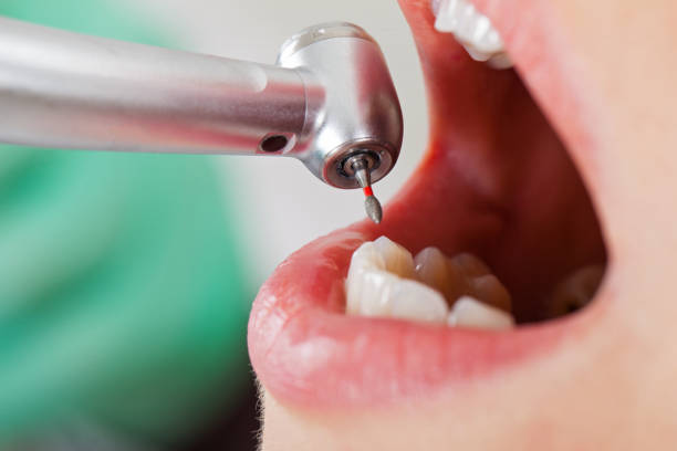 Best Emergency Dental Care for Abscessed Tooth in Comstock Park, MI